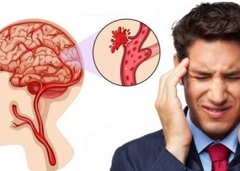 Beyin kanaması belirtileri: Gizli beyin kanaması nasıl anlaşılır?