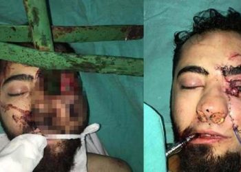 Dehşete düşüren kaza! Ameliyatına itfaiye de girdi