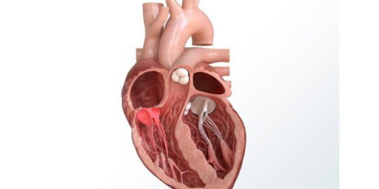 Kalp kapak tedavisinde ameliyatsız yöntemler! Kalp kapak hastalığının tedavisi…