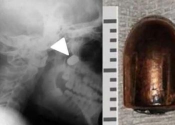 Ukraynalı çocuğun mucize kurtuluşu