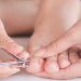 Ayak tırnak batması nasıl geçer? Geçmeyen tırnak batması neden olur?